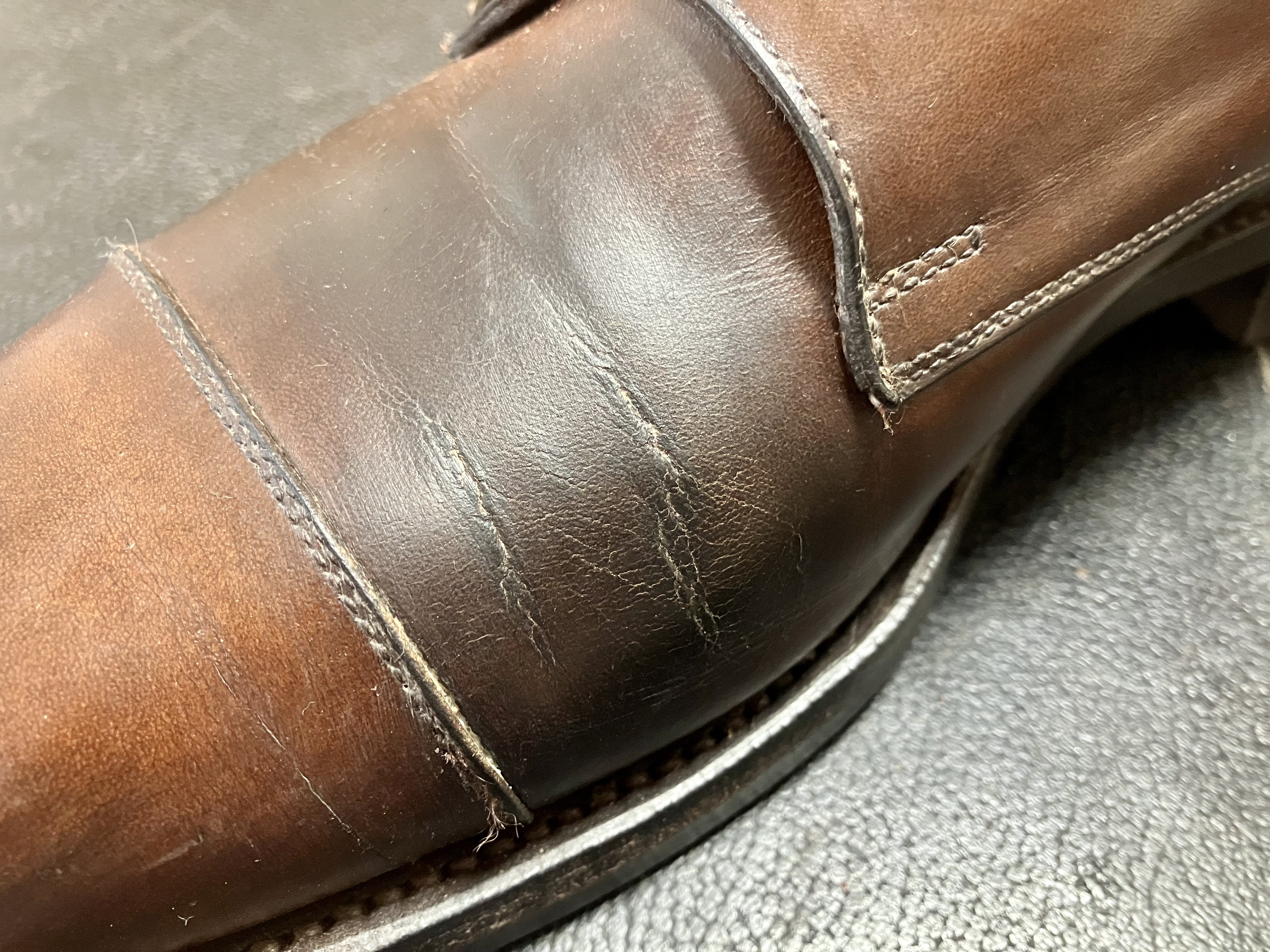 右足内側のひび割れ