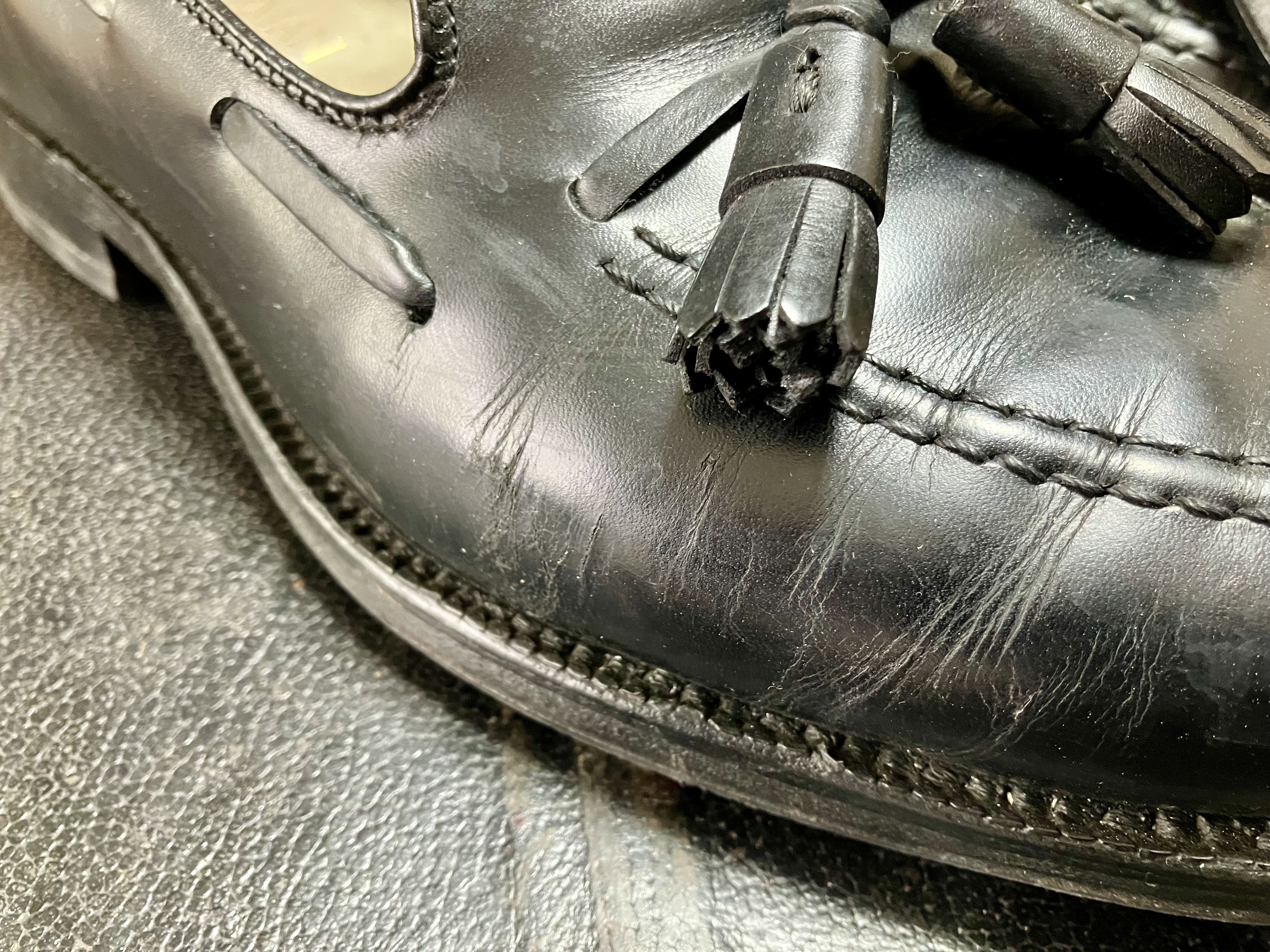 履きジからのひび割れ、クラックが目立つ右足